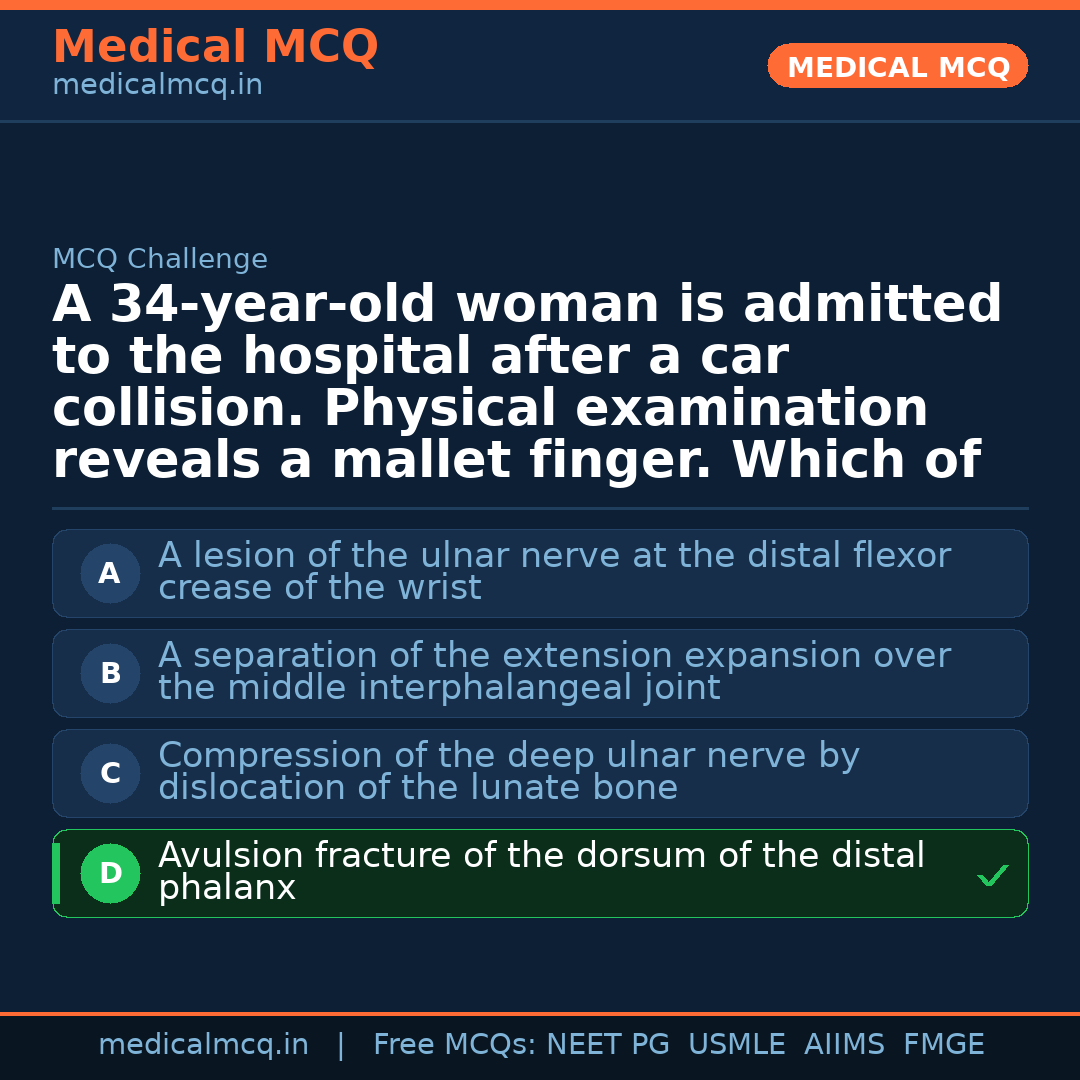 MCQ share card