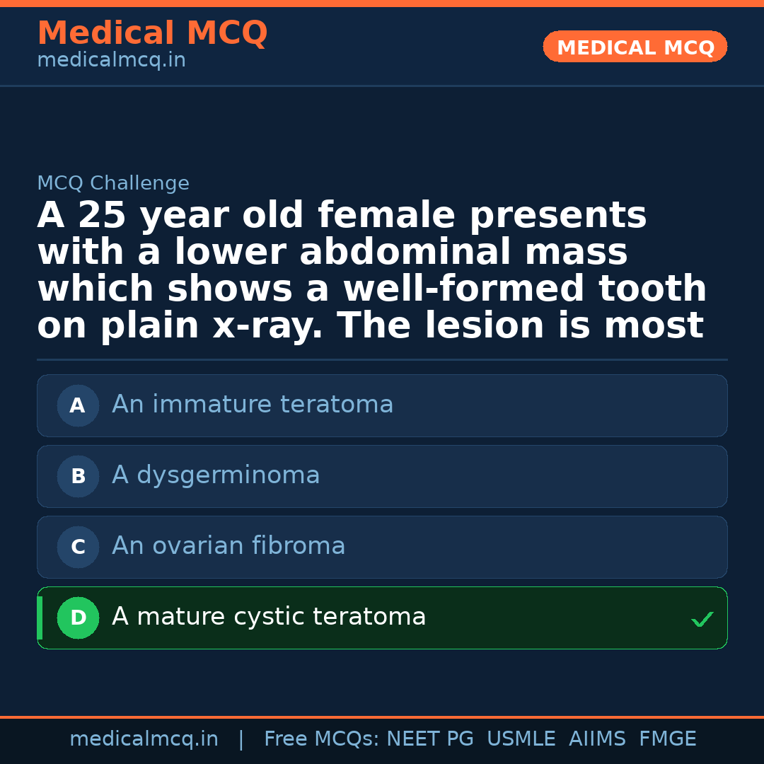 MCQ share card