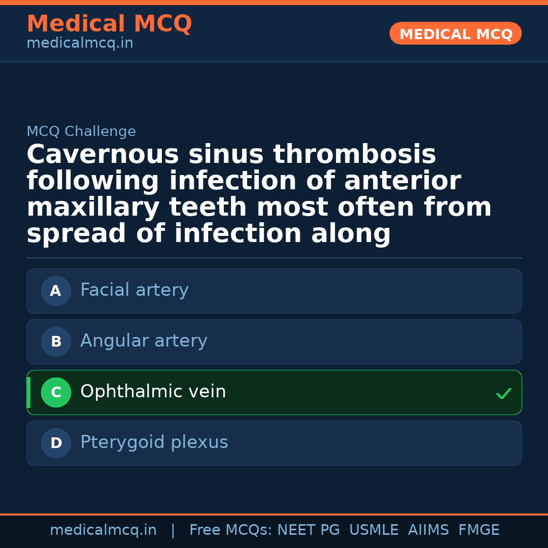 MCQ share card