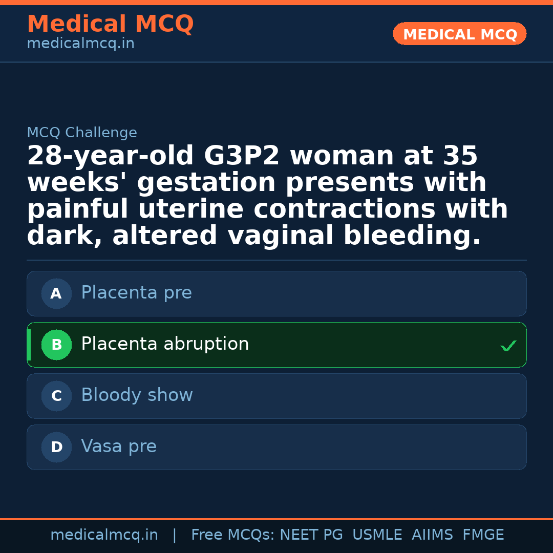 MCQ share card