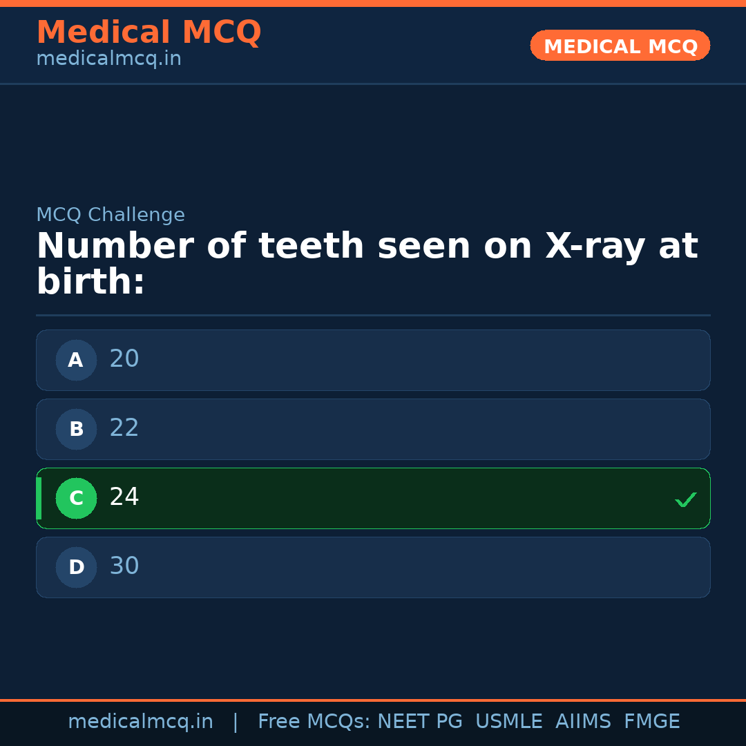MCQ share card