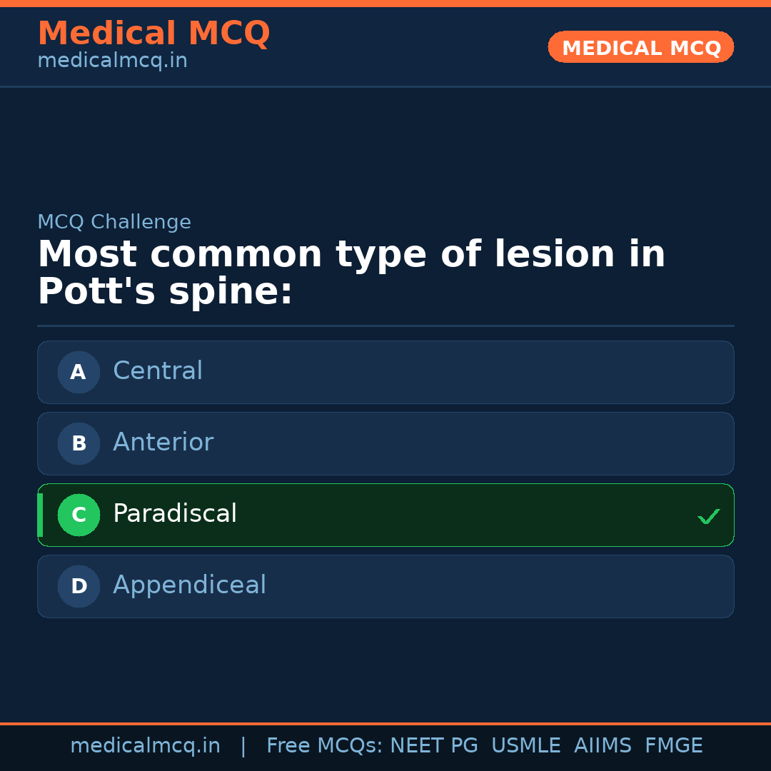 MCQ share card