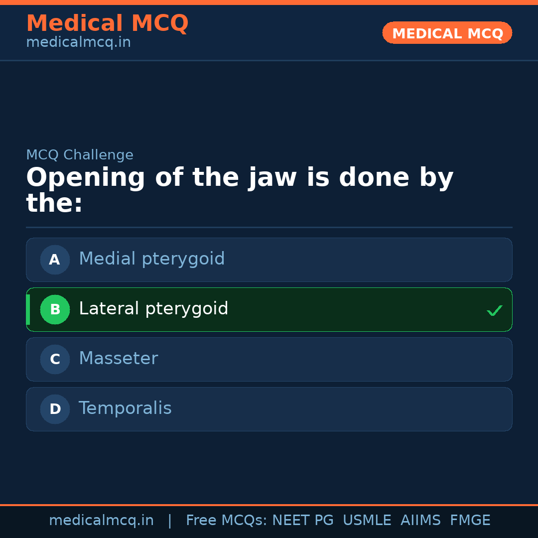 MCQ share card