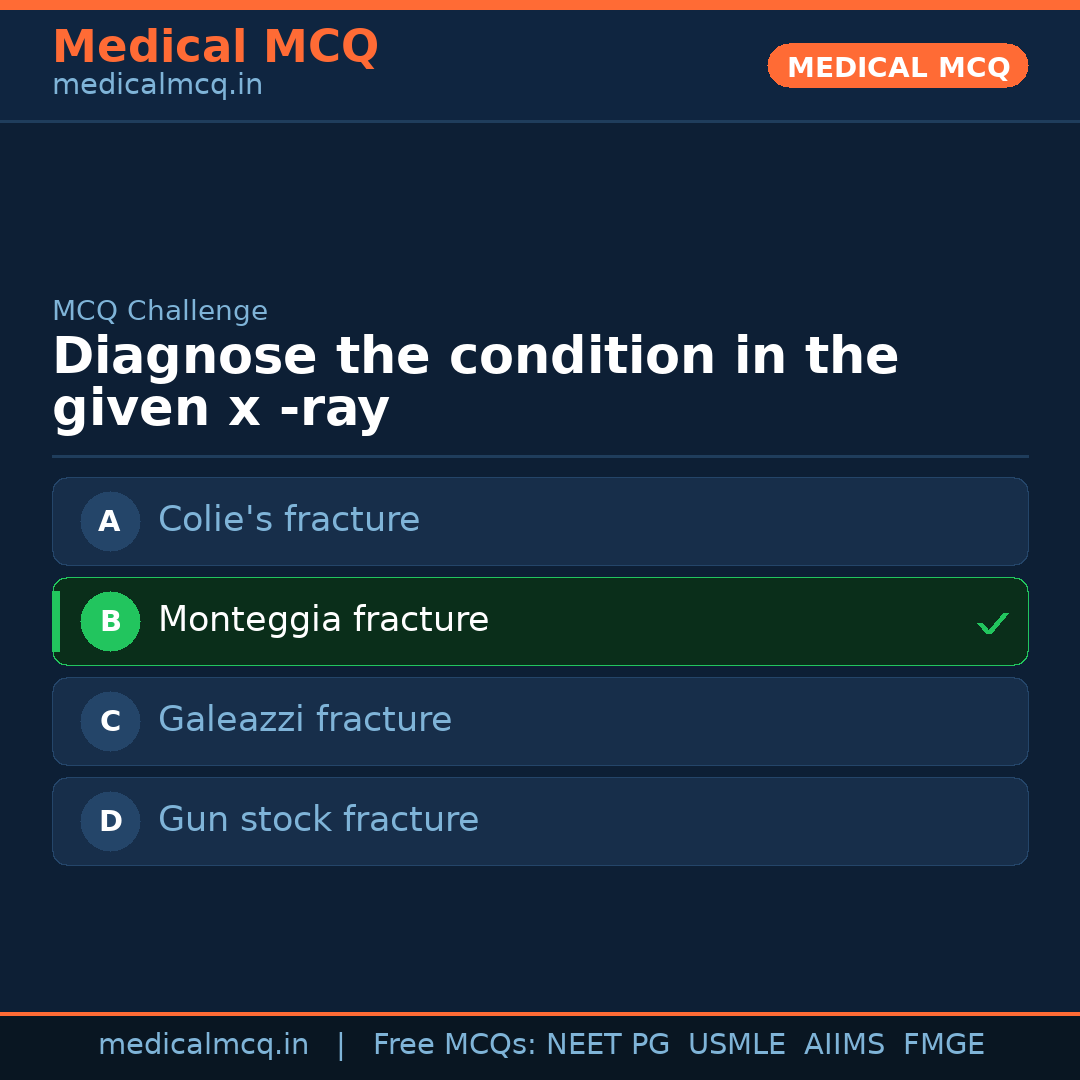 MCQ share card