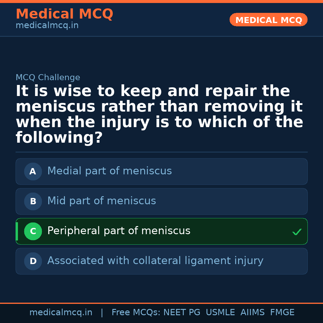 MCQ share card