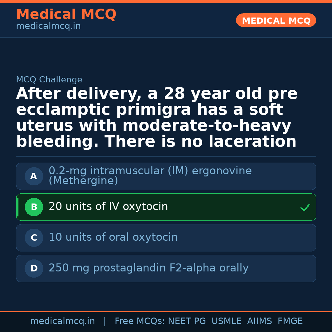 MCQ share card