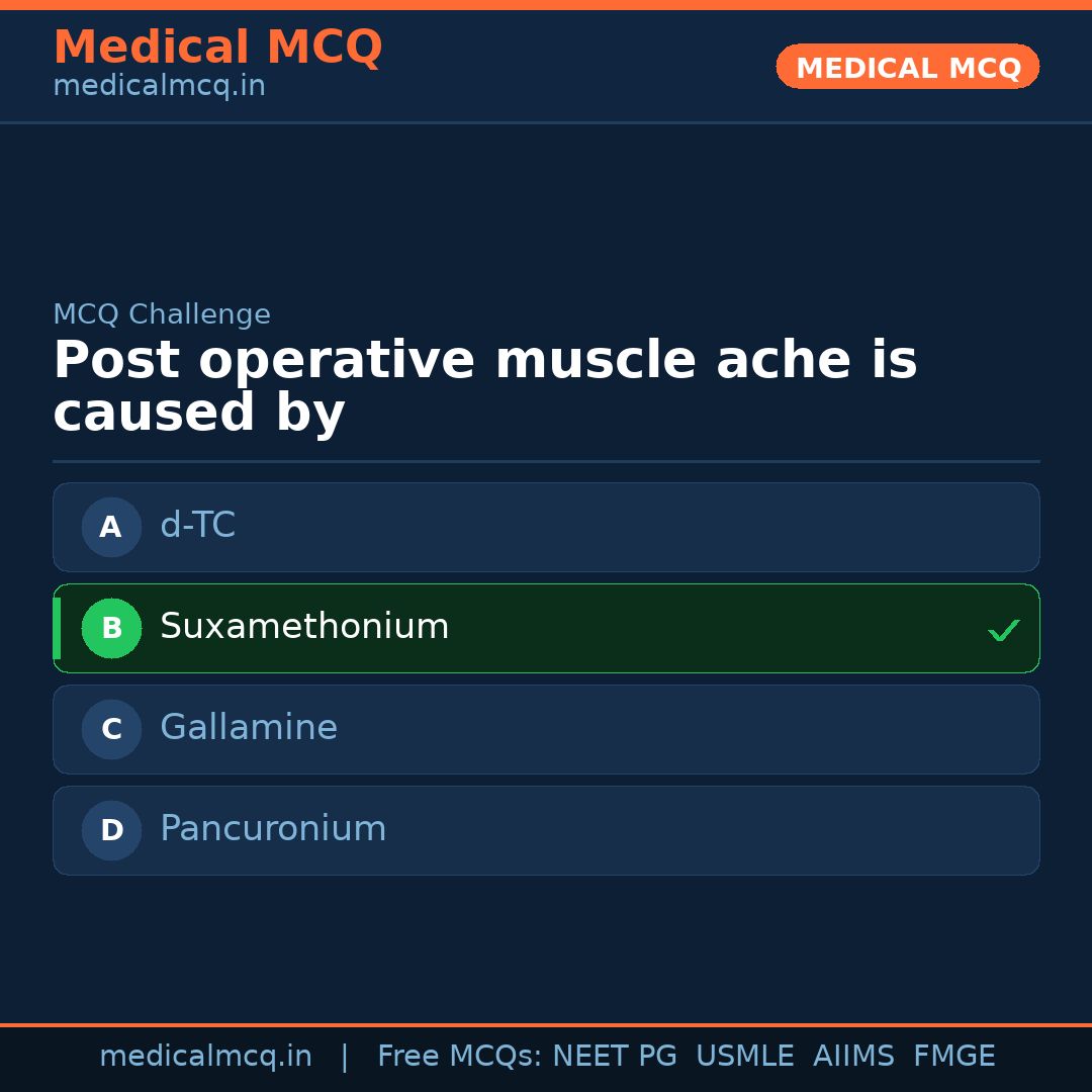 MCQ share card