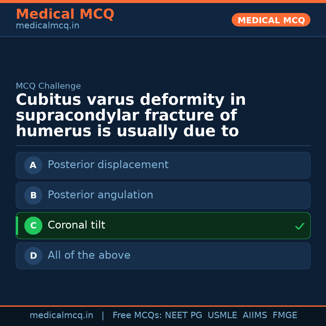 MCQ share card