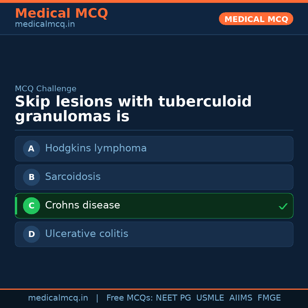 MCQ share card