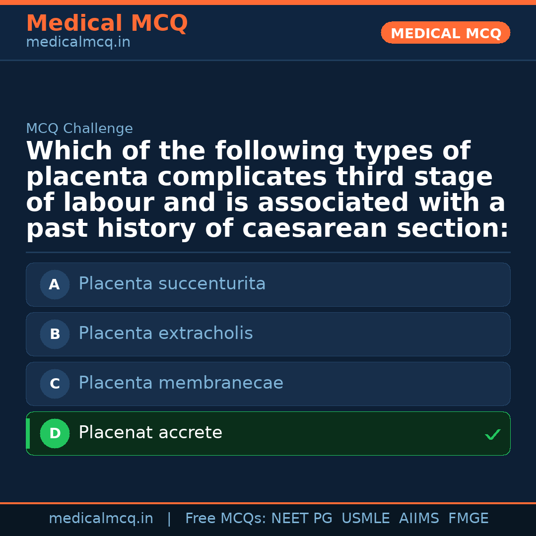 MCQ share card
