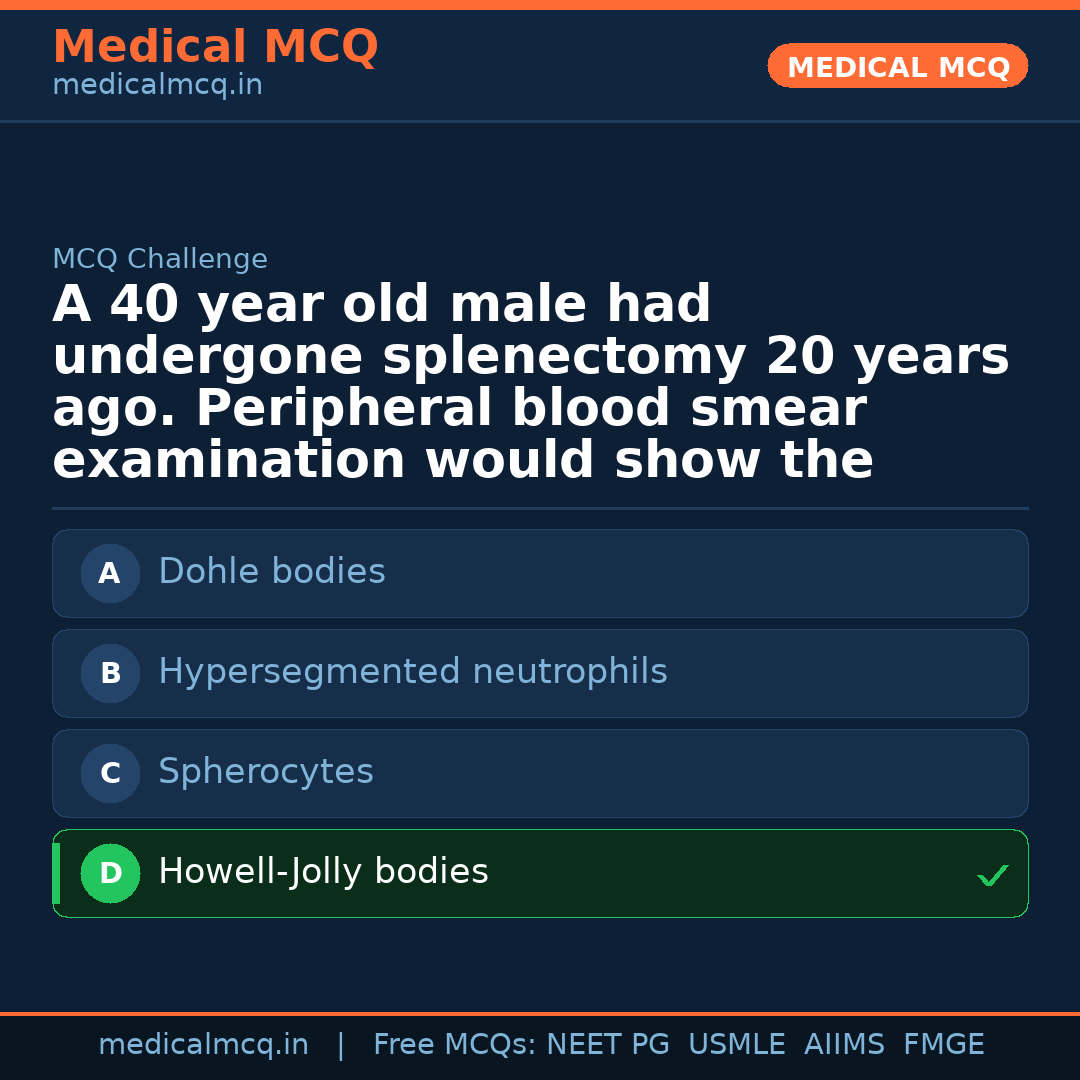 MCQ share card