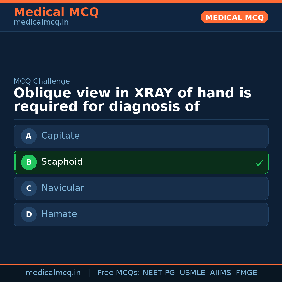 MCQ share card