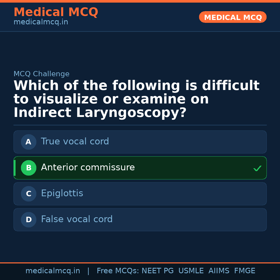 MCQ share card