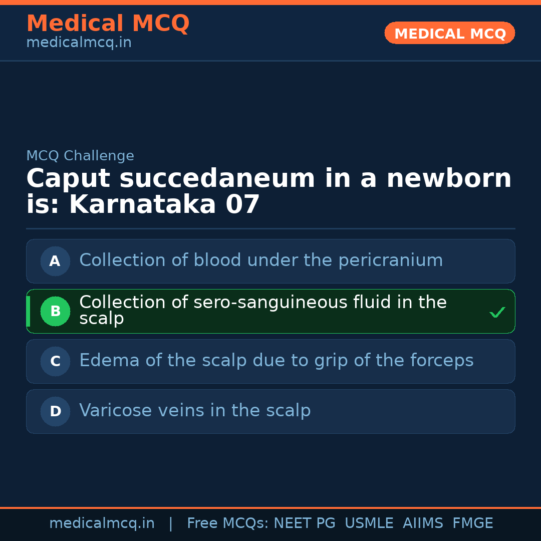 MCQ share card