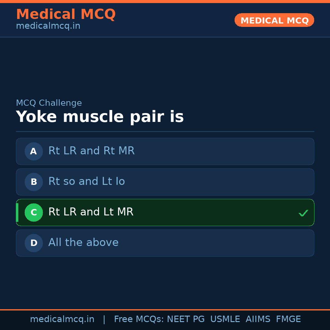 MCQ share card