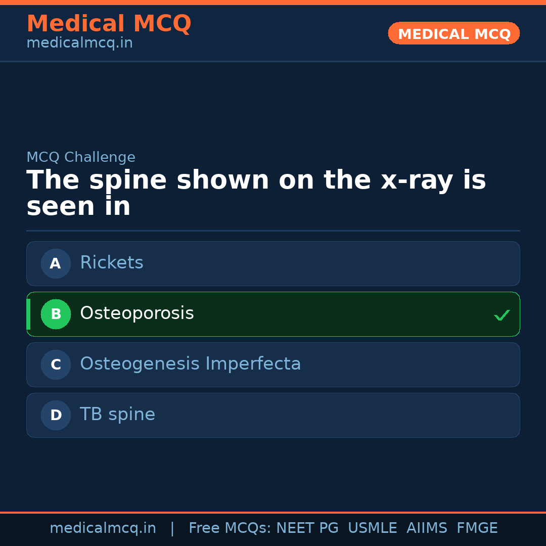MCQ share card