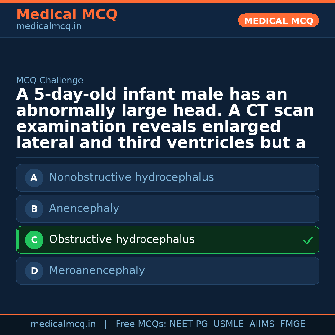 MCQ share card