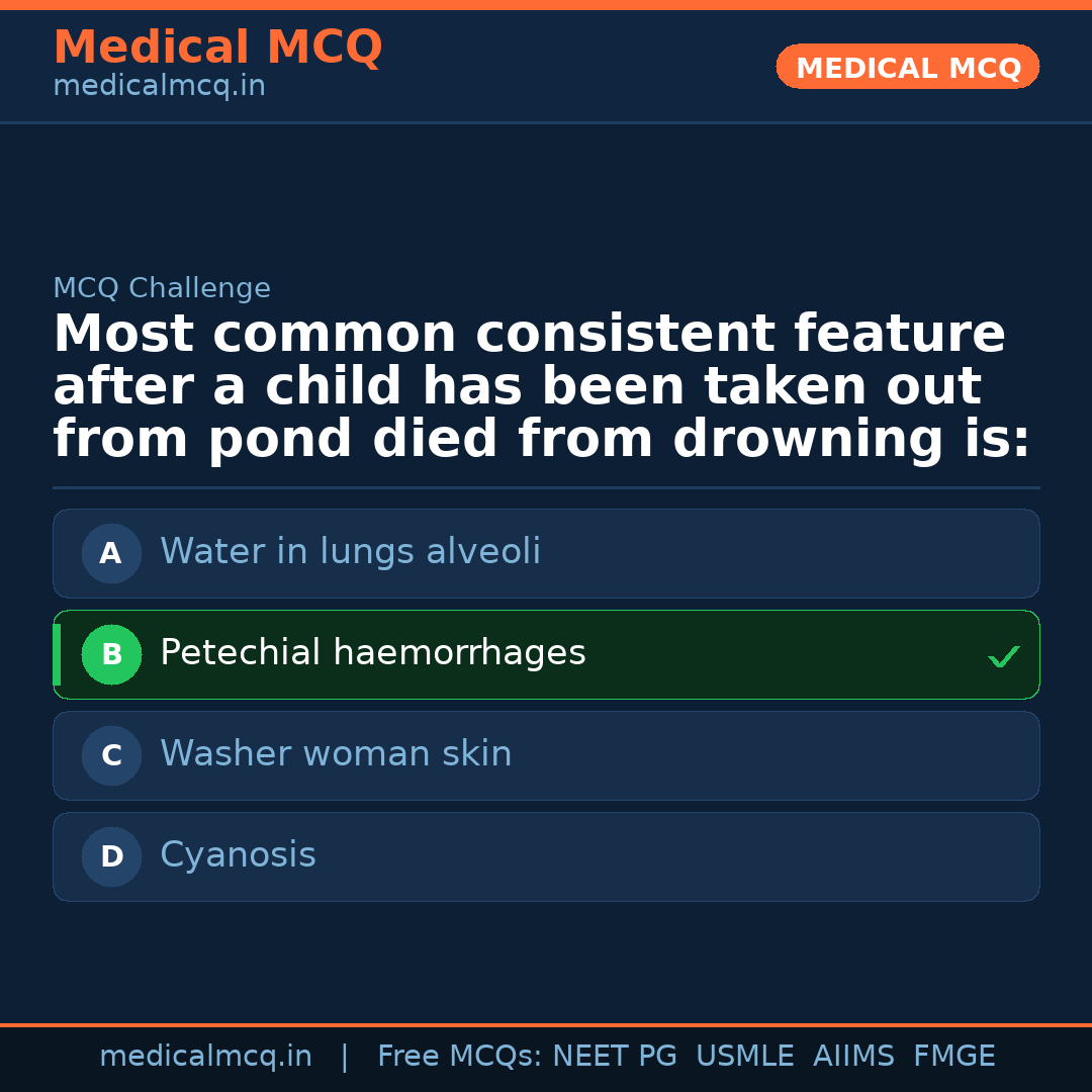 MCQ share card