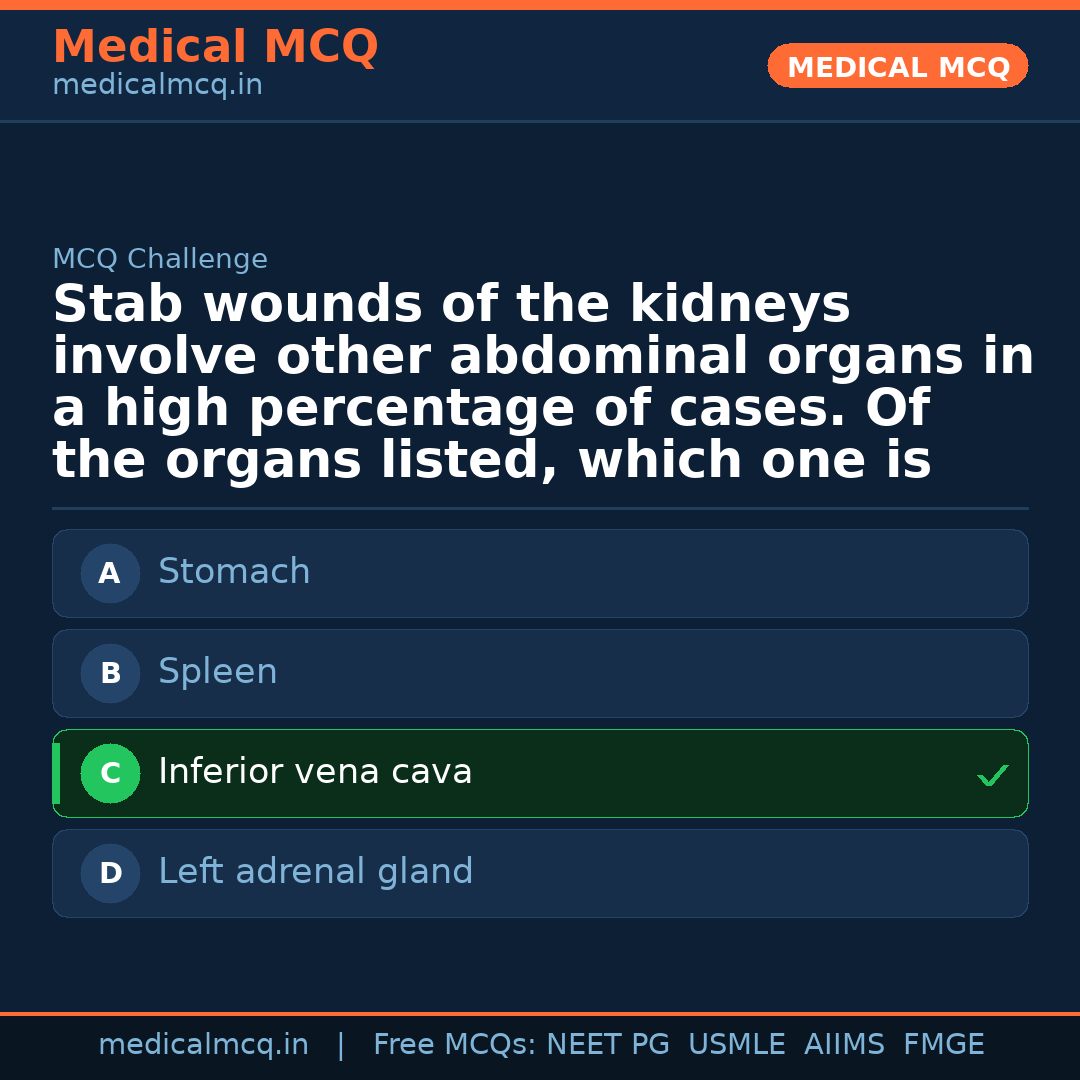 MCQ share card