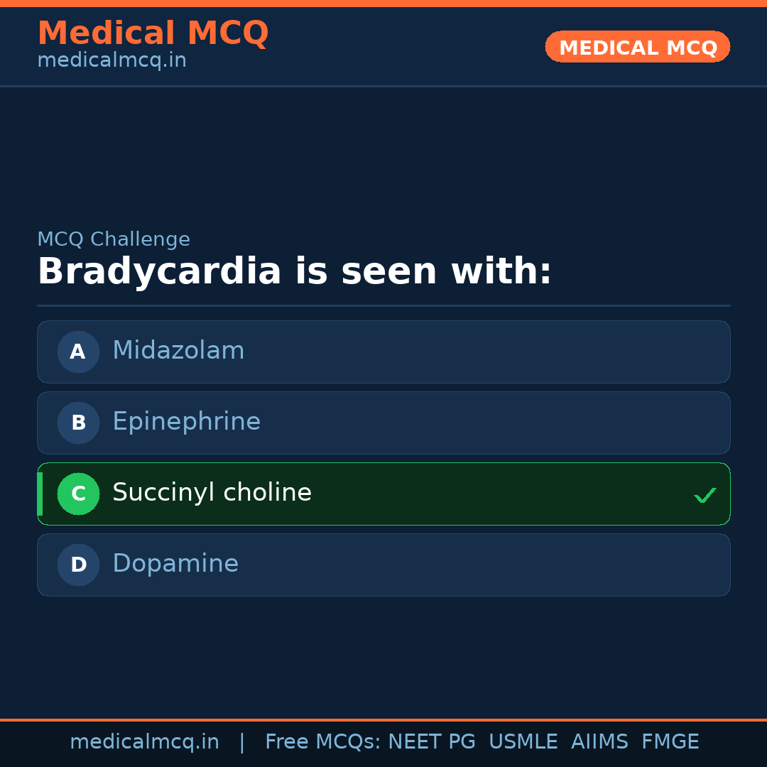 MCQ share card