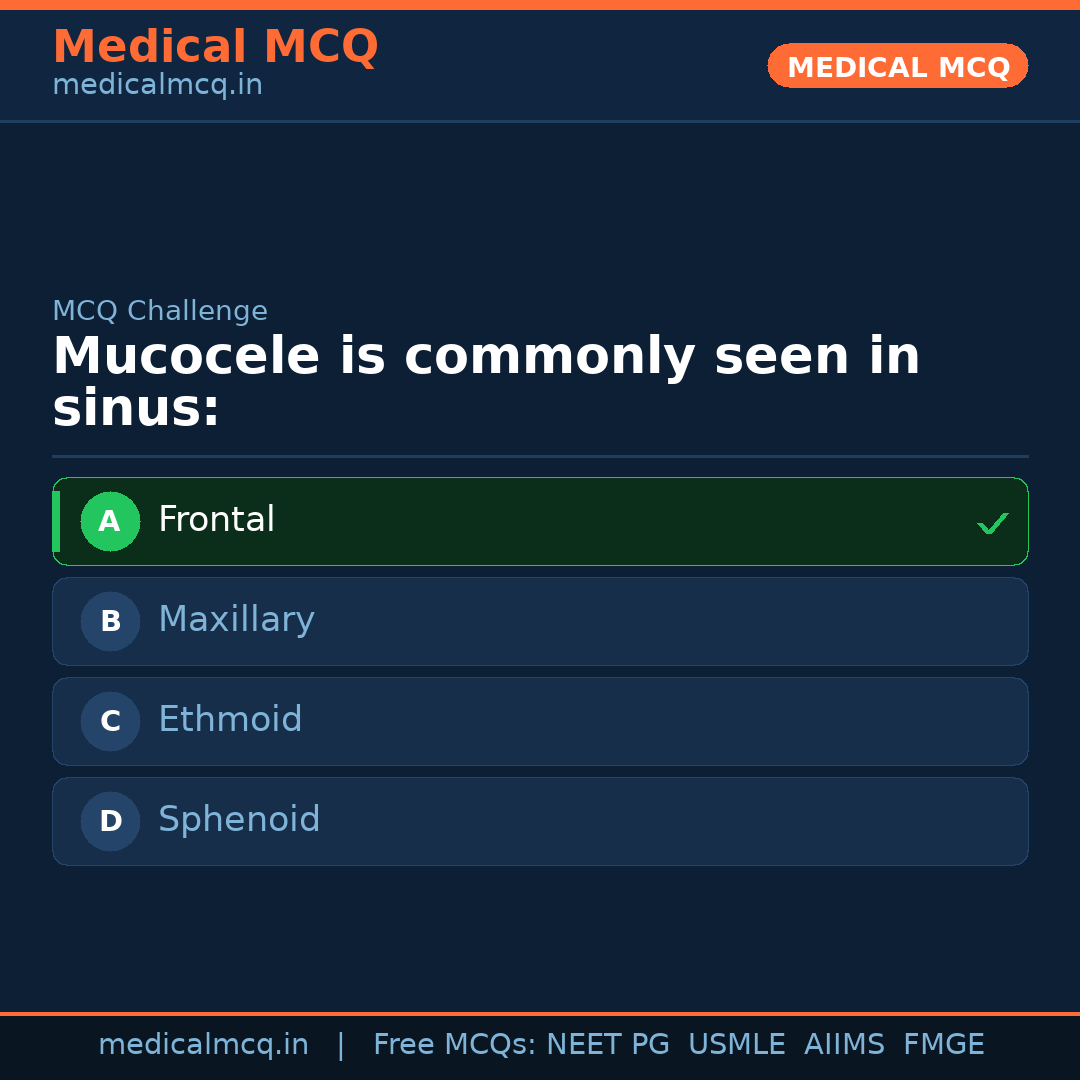 MCQ share card