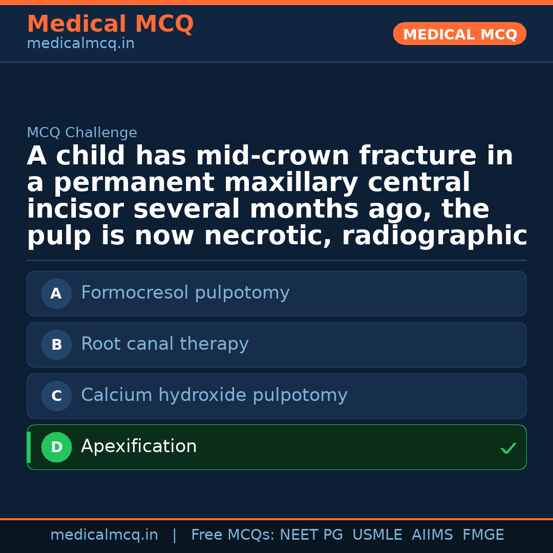 MCQ share card